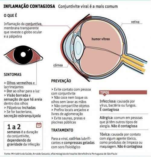 Atenção: Epidemia de conjuntivite atinge São Paulo em meados de Março de 2011