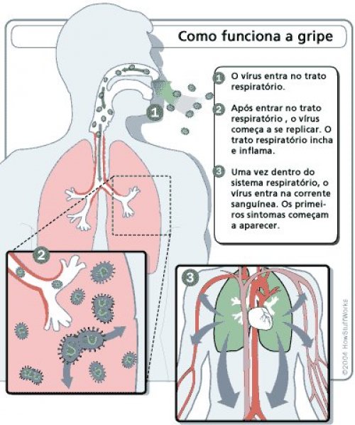 Como funciona a Gripe - Sintomas, Proteção e Tratamento